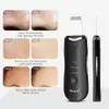 Freeshipping professionele ultrasone gezichtshuid schrobber ionen diep gezicht reiniging peeling oplaadbare huidverzorging apparaat schoonheid instrument