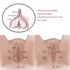 Saúde privada Hifu vaginal aperto máquina rejuvenescimento vaginais tratamento de radiofrequência rf equipamento