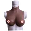 forme del seno trasvedite