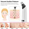 USB Pore Cleaner Blackhead Remover Vacuum Face Skin Care Suction Black Dots Blackheads Pimples Removal Deep Cleaning Tool 26
