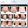 2022 Professional 360 Cryolipolysis Fat Freeze 바디 슬리밍 기계 미니 Cryo Cryotherapy 핸들 더블 턱 제거 FDA 승인