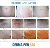 Confronta con articoli simili Sostituzione cartuccia a vite micro ago Per penna dr Derma Pen Penna micro-needling 12 pin / 36 pin / nano