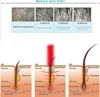 サロンの使用のための1ダイオードレーザー650nmの頭皮の処置レーザーの毛の成長レーザー機械の高品質5