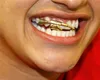 Cool plaqué or pistolet dents Grillz or dents grilles haute qualité hommes Hip Hop bijoux cadeau pour ami