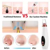 USB -uppladdningsbar Blackhead Remover Face Pore Vacuum Skin Care Acne Pore Cleaner Pimple Removal Vakuumsug Ansiktsverktyg Limpieza Removeor de Espinillas