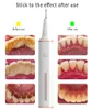 Justlang-irrigador Dental Visible con Wifi, limpiador Dental ultrasónico, blanqueador, irrigador eléctrico de agua, eliminador de cálculo por chorro