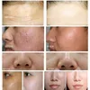 多機能美容装置Hifu Skin Care V-Max Machine Cleansing Resurfacing Bio MicroCurrent Face Lift Spa Salon使用