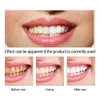 Lanbena dientes blanqueamiento esencia en polvo higiene oral limpieza suero elimina la placa mancha dental blanqueo dental herramientas dentales pasta de dientes