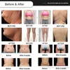 Máquina profissional de emagrecimento de criolipólise Dispositivo de perda de gordura Remoção de queixo duplo RF Laser Lipo Body Slim Equipamento para salões de beleza 2 anos de garantia Personalização do logotipo