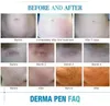Professional Microneedle Rechargeable Purple dr M7 pen derma pen ultima with 5 speed adjustment