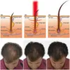 2021 Pettine laser per la ricrescita dei capelli con terapia laser a basso livello con laser per uso domestico personale