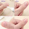 Dropshipping Cuticle Revitalizer Oil Fruits Nail Art Behandling Manicure Soften Pen Tool Nail Cuticle Oil för Nail Tips Makeup Tools