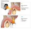 Ed Shockwave-Behandlung Akustikwelle Shcok-Wave-Therapie-Vakuum Shcok-Wellenmaschine für Fettverringerung mit 7 Tipps