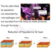 Dubbelkanaler 360 ° Kylkroppsformning Kryolipolys Slimmimg Maskinfett Frysning Kryoterapi Skönhetsutrustning för avlägsnande av celluliter