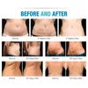 Yeni Model 40K Ultrasonik Liposuction Kavitasyon 8 Pedler Lazer Vakum RF Cilt Bakımı Salon Spa Zayıflama Makinesi Güzellik Ekipmanları 014