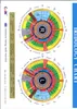 2022 Новый 12 -мегапиксельный USB Iris Iridology Iriscope Eye Analyzer Analyzer цифровые иридологические камеры для диагностики здоровья у испанского корейского порта1036653