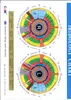 2023 New 12MP USB IRIS IRIS IRIDOLOGY IRISCOPE EYEカメラアナライザーデジタルイリドロジーカメラ