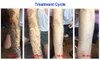 ND YAG пикосекундная лазерная татуировка удаления кожи отбеливание кожи Удалить веснушки красоты устройства для салона с 4 длиной волны