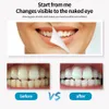 Display a LED Scaler dentali Electric Ultra Dental Dente Remover Deterino Punte per denti Tartar Strumento Bianco Denti Tartar171A5491342