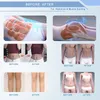 CE 인증서 emslim neo hiemt body slimming rf 자극 근육 장비 지방 연소 2 년 보증 로고 사용자 정의