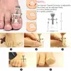 12PCS / SET Professionell Pedicure Tools Ingrown Toenail Tools Kit Nail Care Ingrown Toenail Removal Correction Clippers Foot Care 210304