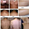 Лазерная постоянная машина для удаления волос IPL Опение Elight Skin Care Pigment Therapy Spa Spa оборудование