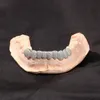 custom teeth
