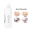 High Quality New Multifunctional Portable Ultrasonic Skin Scrubber Face Lifting Cleaner Massager Spa Home Use Beauty