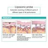 HIFU Liposonix Machine Ciało Odchudzanie HIFU Face Lifting ultradźwięki Anti Aging Skóra Dokręcanie Liposonic Sprzęt