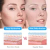 Face Care Devices Diamond Microdermabrasion Dermabrasion Machine Facial Schoonheid Vacuüm Spray Zuigvaccum Afschilfering Gezichtsmassage