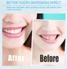 Strisce di sbiancamento dei denti 14 Pouches 28 Striscia Igiene orale per la rimozione delle macchie Uso domestico