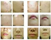 High End Face Care Skin Rejuvenation Beautyantiaging Vätvatten PDT Syre Spray LED Lätt Acne Treating Machine4158049