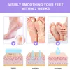 rose Aloe Exfoliating Foot Mask Hand Mask Socks Peel Off Remove Dead Skin Foot Care Foot Spa Treatments 2Pcs=1 Pair Moisturizin