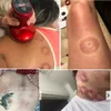 Home Wireless Charging Electric Cupping Massager Cupt Cups Ems Ventosas Anti Cellulite Magnet Therapy Guasha Dragting FA8512692