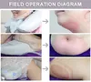 2 Cryo-handgrepen 360 Cryolipolysis Vet bevriezen Afslanken Machine Vacuüm Afslanken Uitrusting Coole Tech Sculpting Body Shaping Doublechin Treatment Equate