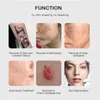 Meest populaire laser picosecond acne behandeling pigment laserbehandeling tattoo verwijderen Korea zwarte pop behandeling schoonheid machinesalon gebruik