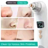 Heating Blackhead Remover Pore Vacuum Cleaner For Nose Face Skin Acne Sucker Rechargeable LCD Display Suction Spot Removal Tools 220114