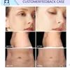 Cavitação de gordura máquina doméstica celulite massageador a vácuo lipo laser perda de peso 80k ultrassônico rf máquinas de contorno corporal 6 alças