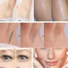 OPT IPL Depilazione Apparecchiatura multifunzionale di bellezza Nd Yag Laser Rimuovi tatuaggi Elight Macchina per il ringiovanimento della pelle