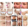 4 in 1 40khz cavitation body shaping slimming cellulite reduction skin tightening massage machine