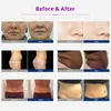 RF Body Slim Machien Facial Lifting Care Salon kosmetyczny Salon antyalukowy Waga LOS Maszyna ET76D2