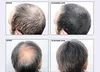 HAIR LOSS CONCEALER Hair BUILDING FIBERS Natural Keratin Hair Loss Restore Instant Conceal 25g DHL 1187317