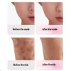 Plasma Laser Freckle Remoção Caneta Facial Skin Cuidados Mole Dark Spot Limpador Tag Tag Tattoo Remove USB Mini Beleza Ferramenta