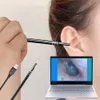 endoscope de nettoyage de l'oreille