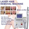 pulsed nd yag laser