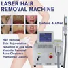 epilator hair removal machine