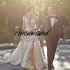 Elegante afneembare trein kant zeemeermin trouwjurk sexy backless appliques korte mouw tuin strand champagne trouwjurken