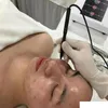 Professionell Korea Technology RF Utrustning Acacia Acne Behandling Enhet Spot Scars Removal Machine Hudvård Föryngring Skönhetssalong