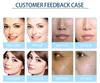Snabb leverans Microdermabrasion Home Skin Scrubber Facial Dermabrasion Hydra Microcurrent Face Machine Fuktgivande rynkborttagning Ultraljud
