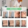 Cellulitis Reduction Sliming Machine Spier Massage Professionele Vela Slim Vorm Vacuüm Rollar Ultrasone Cavitatie RF-systeem